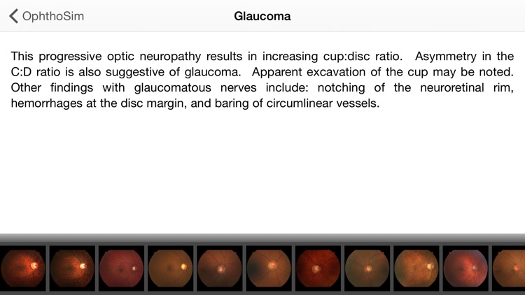 OphthoSim Companion screenshot-4