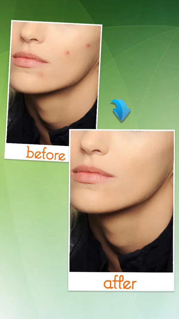 Photo Eraser 截图 2