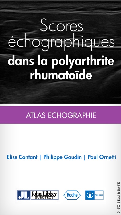 SCORES ECHO : Scoring échographique dans la polyarthrite rhumatoïde