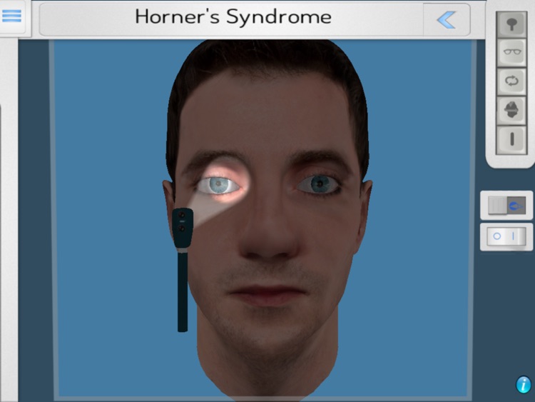 NeuroOphthal screenshot-3