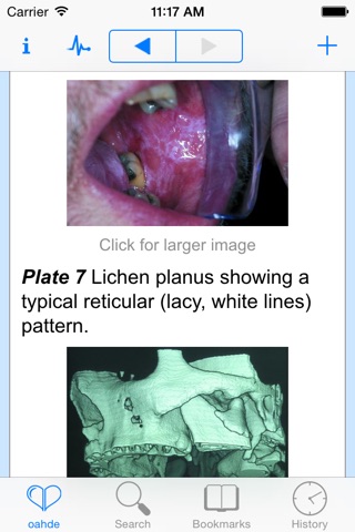 Oxford American Handbook of Clinical Dentistry screenshot 3
