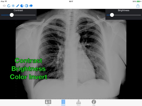 DICOM IR screenshot 4