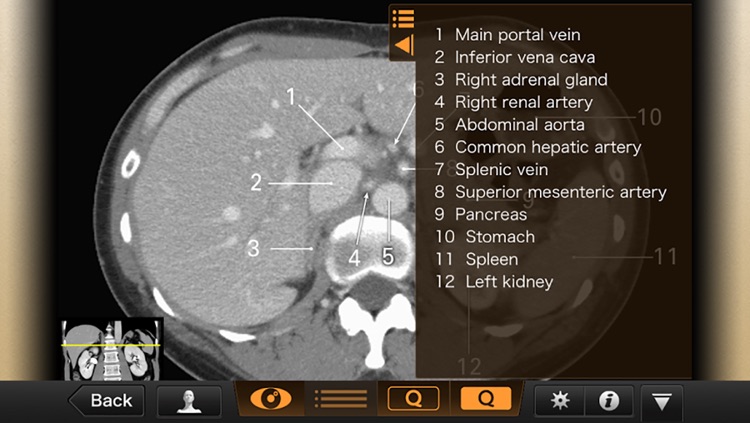 Interactive CT and MRI Anatomy