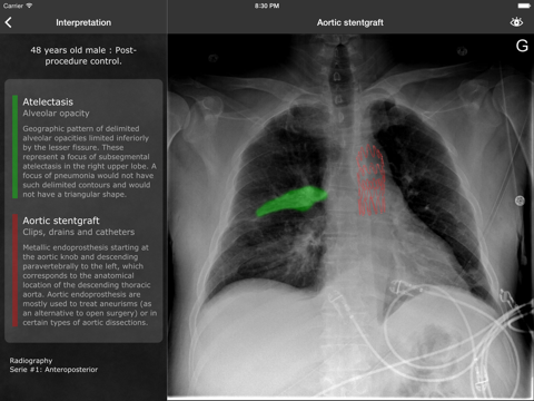 RealWorld Radiologyのおすすめ画像4