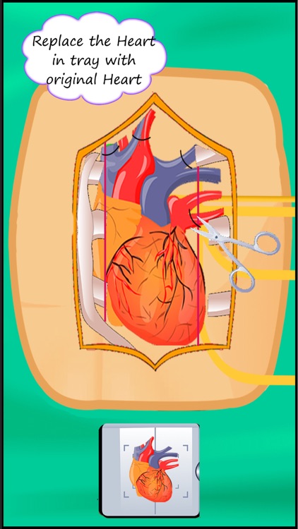 Heart Surgery Simulator : Free Virtual heart transplant Game screenshot-4