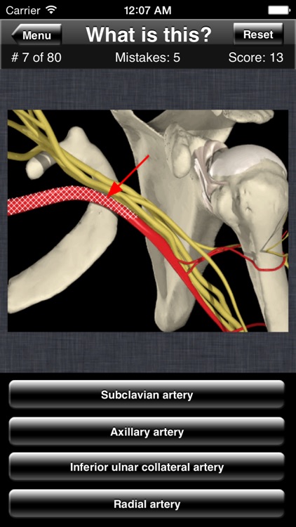 Anatomy Shoulder Quiz screenshot-3