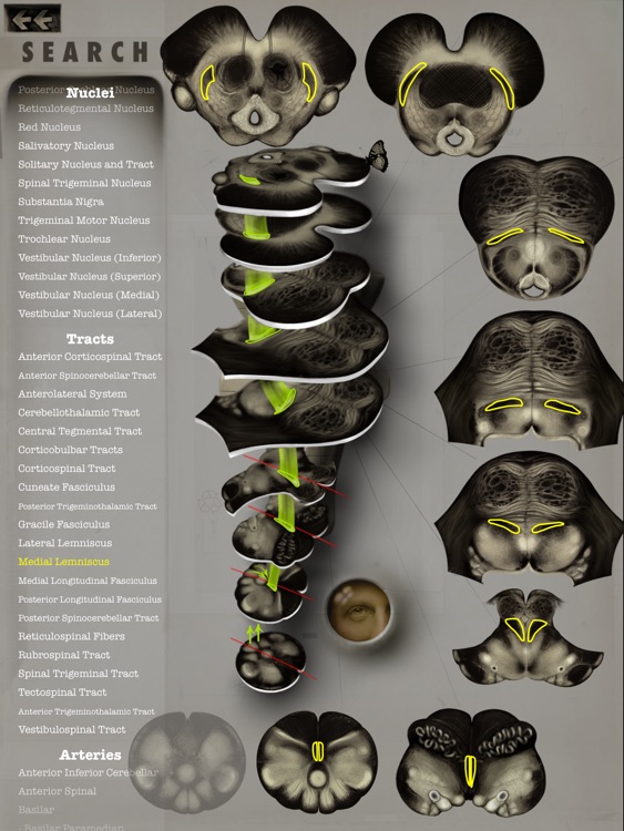 Brainstem101 - Neuroanatomy of the Human Brainstem