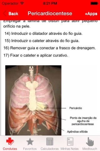 Condutas em Emergência - Pronto-socorro, paramédico, terapia intensiva e plantãoのおすすめ画像5