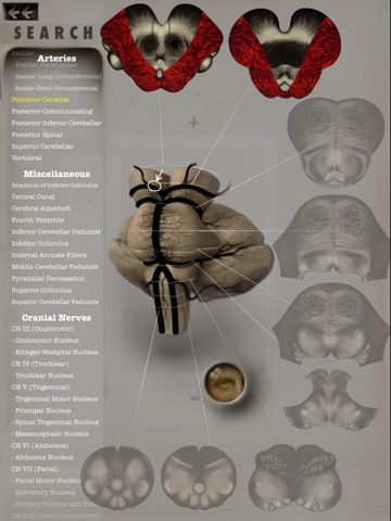 Brainstem101 - Neuroanatomy of the Human Brainstem screenshot 2