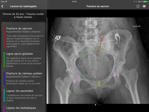 Screenshot #6 pour RealWorld Orthopaedics