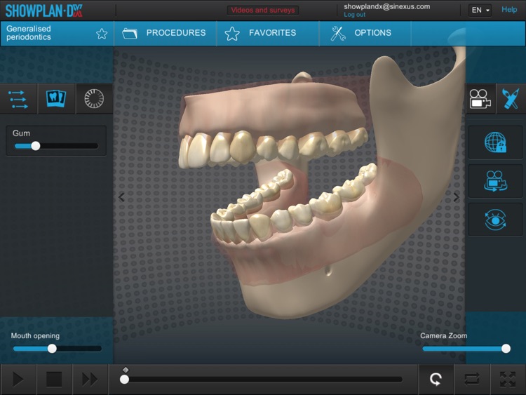 Showplan-DX - Dental screenshot-4