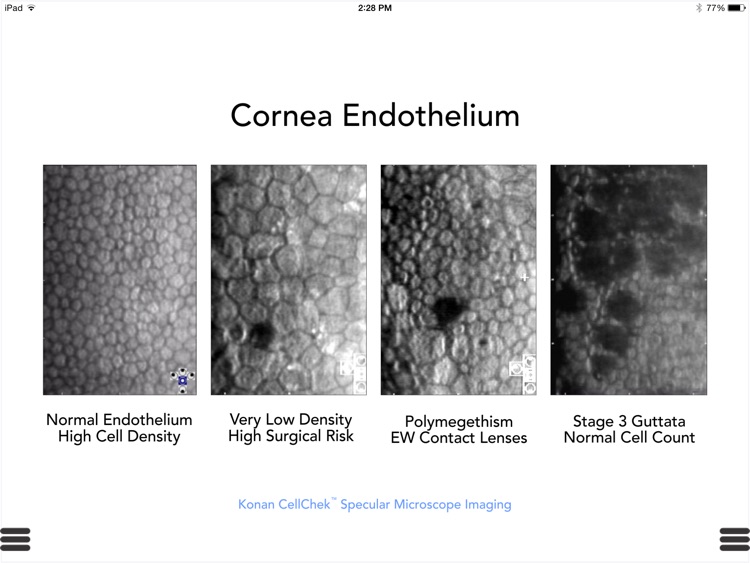 Ophthalmic Media Library screenshot-4