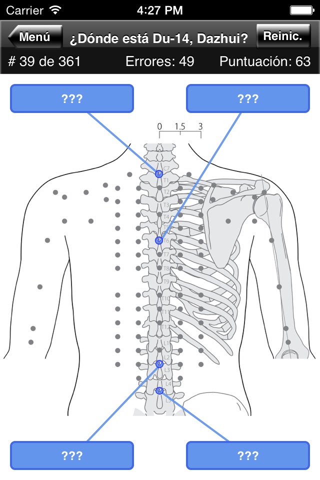 Acupuncture Points Body Quiz screenshot 2