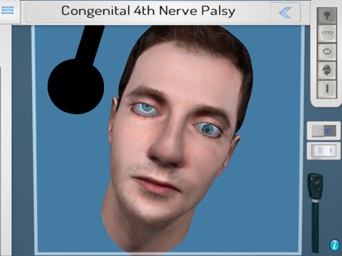 NeuroOphthal screenshot 2