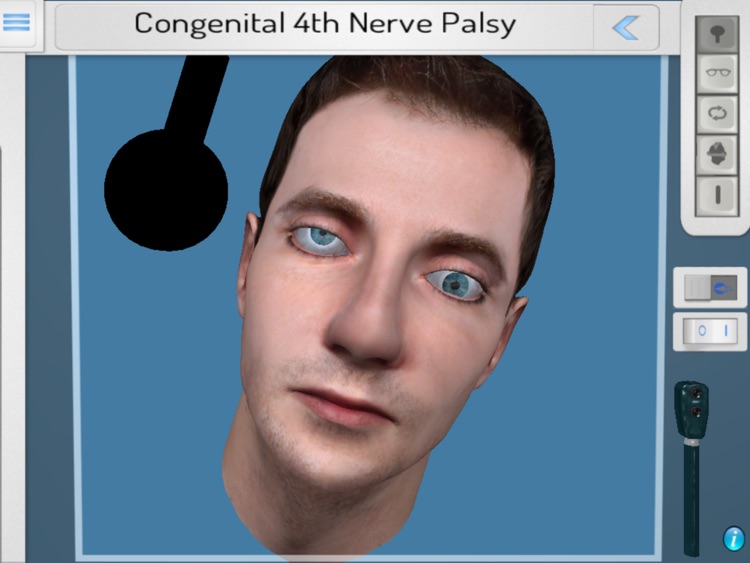 NeuroOphthal