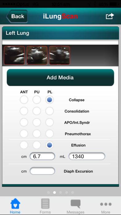 Screenshot #1 pour iLungScan™