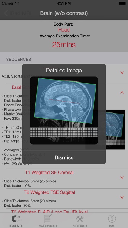 iRad MRI