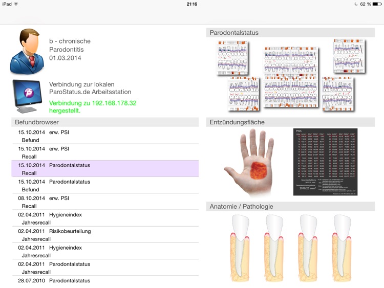 ParoStatus.de SideView