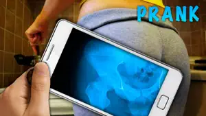 Simulator X-Ray Hip Bone screenshot #1 for iPhone