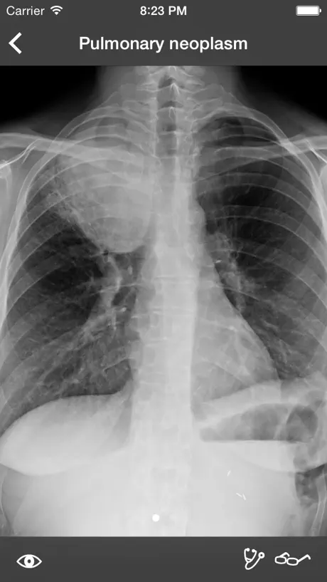 RealWorld Radiology