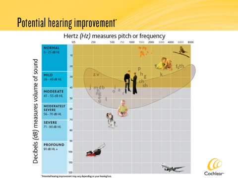 Cochlear Consult screenshot 2