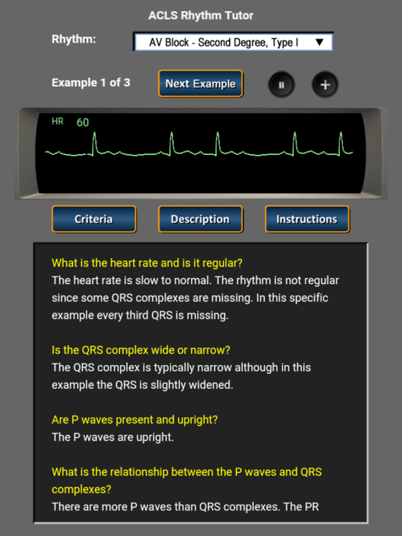 Screenshot #5 pour ACLS Rhythm Tutor