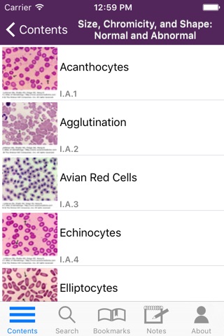 Lichtman's Atlas of Hematology screenshot 3