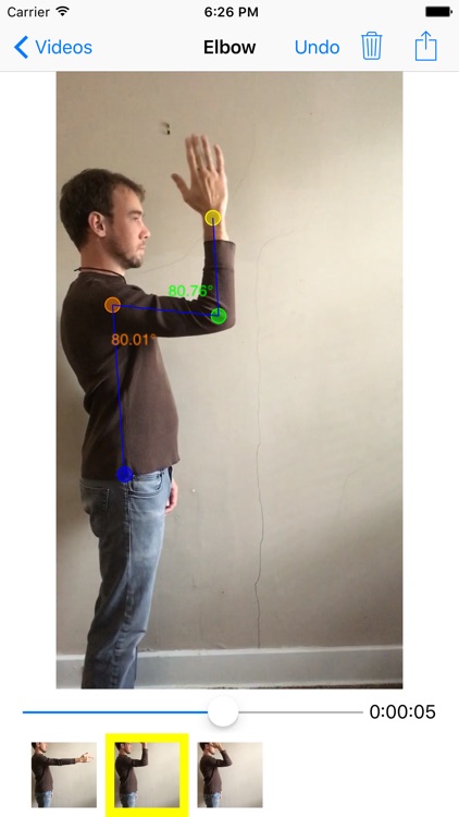 Angles - Video Goniometer