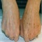 How To Remove Liver Spots is an app that includes some helpful information on Liver Spot and How to Remove it