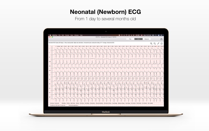 Screenshot #3 pour ECG PRO - for EMT