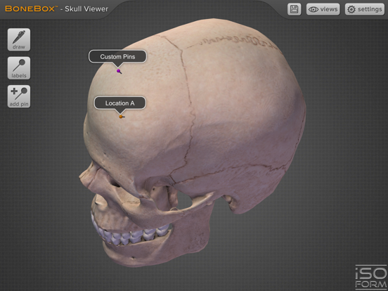 BoneBox™ - Skull Viewerのおすすめ画像4