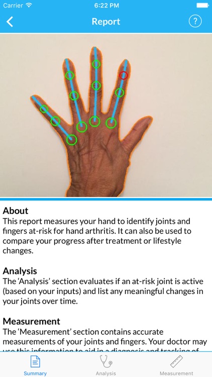 LiveWith Arthritis UNMC
