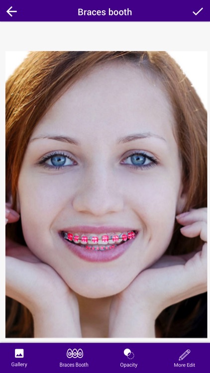 Braces Camera Photo Editor