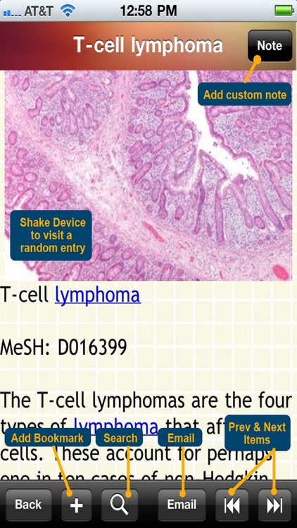 Blood Disorders Encyclopedia screenshot-4