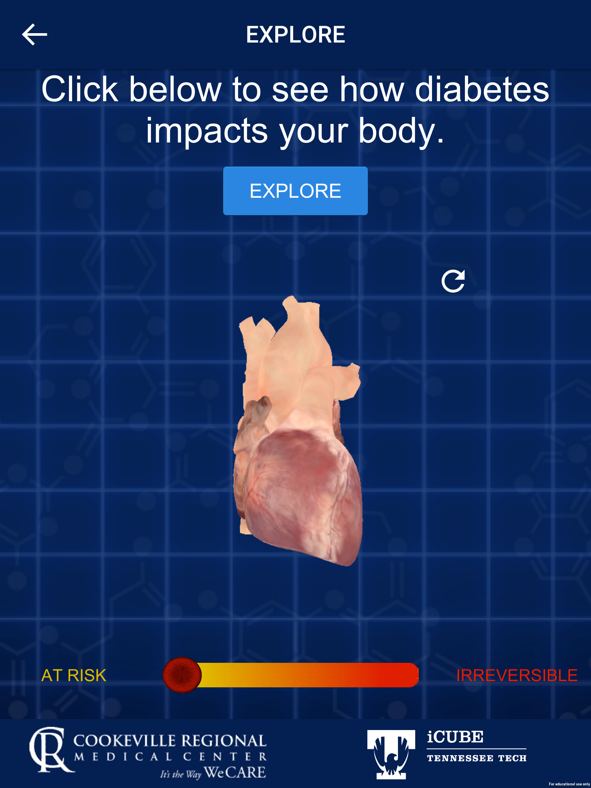 Diabetes In Your Body