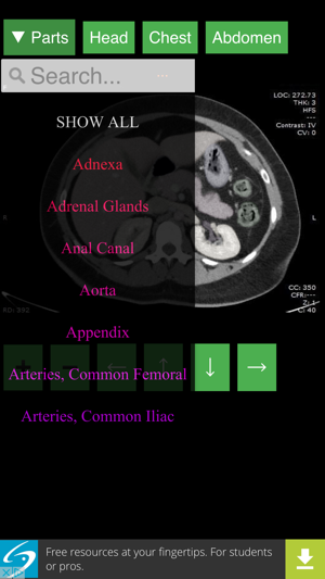 Anatomy on Radiology CT(圖3)-速報App