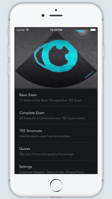 ECHO Views - Transesophageal Echocardiography Atlas Screenshot 3