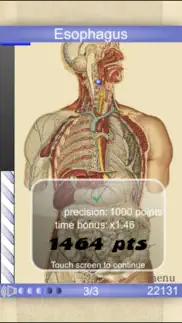 speed anatomy lite (quiz) iphone screenshot 2