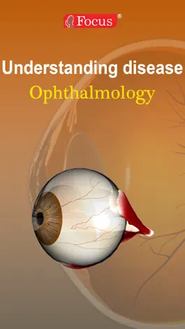 Game screenshot Ophthalmology - Understanding Disease mod apk