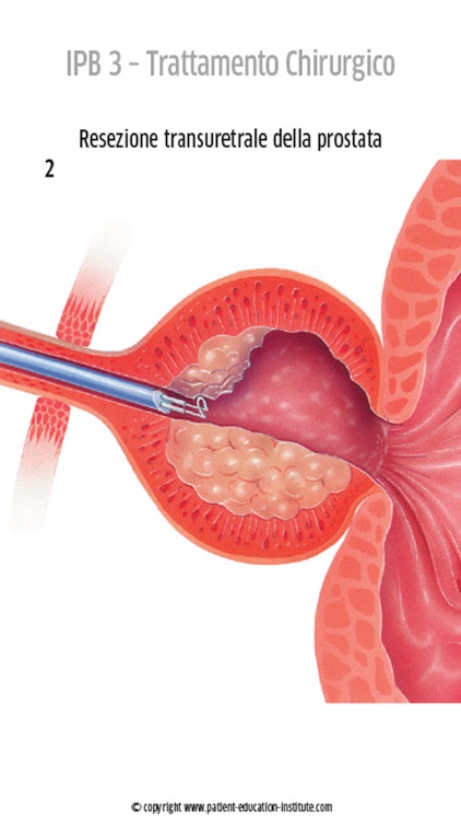 SIU, Urologia, phone app