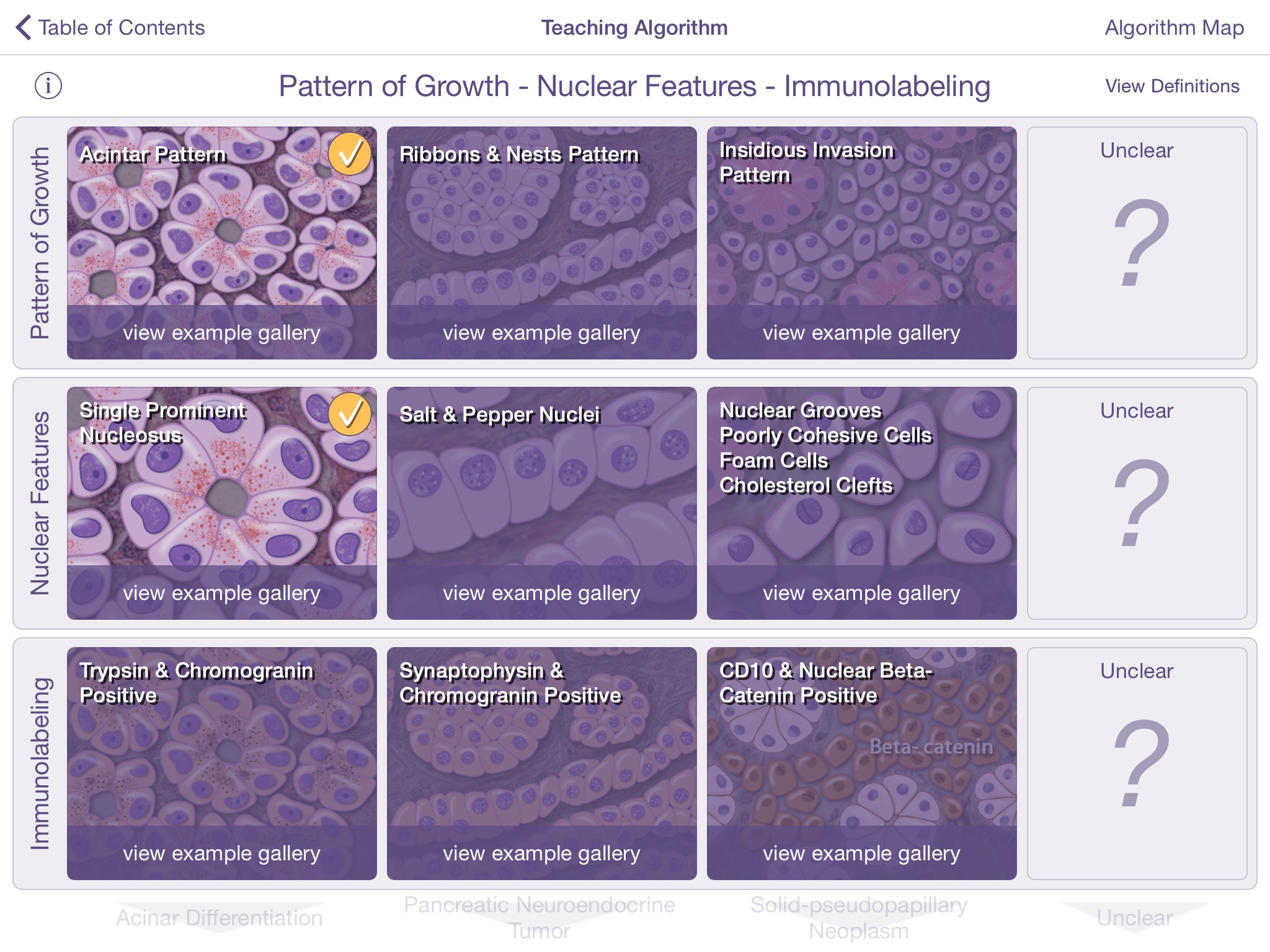 Johns Hopkins Atlas of Pancreatic Pathology screenshot 4