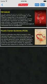 gynaecology - understanding disease iphone screenshot 2