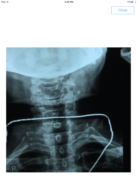 Screenshot #4 pour Prescrip