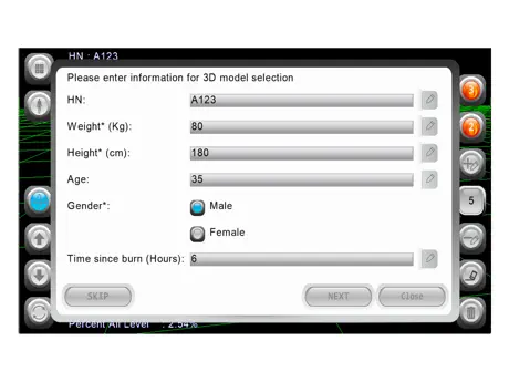 3D Burn Resuscitation