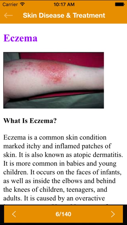 Ayurvedic Home Remedies : Beauty Treatment Tips screenshot-4