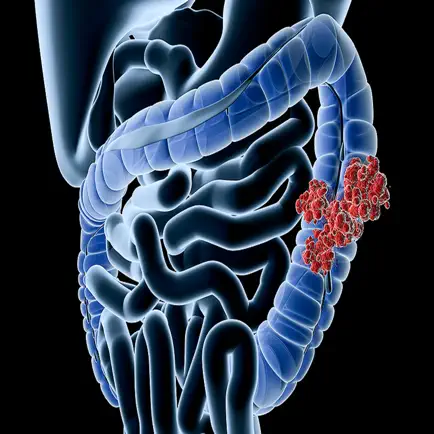 Colo-Rectal Cancer Screening Читы