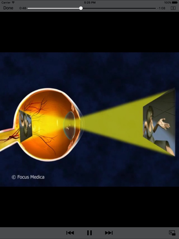Ophthalmology - Understanding Disease iPad screenshot 4 - Medical app