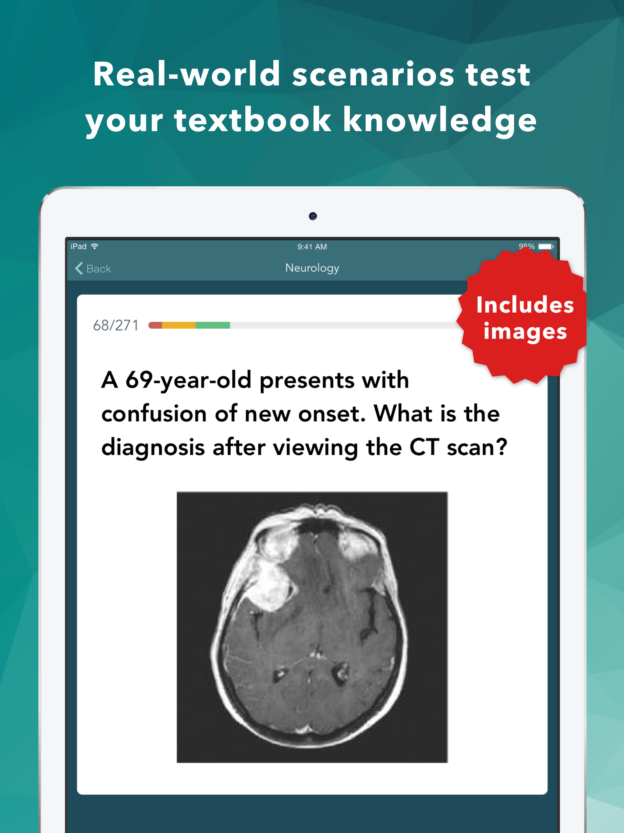 Family Medicine Board Review Practice Questions