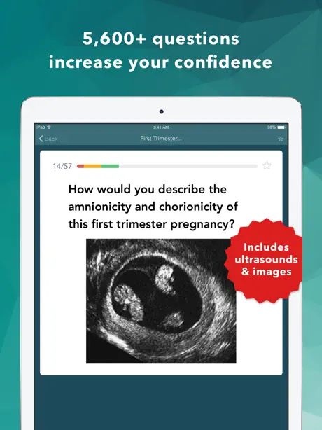 Ob Gyn Board Review Flashcards