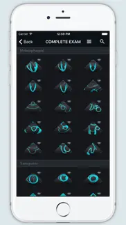 echo views - transesophageal echocardiography iphone screenshot 1